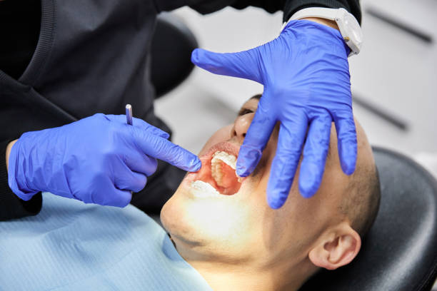 Best Broken or Chipped Tooth Repair in West Grove, PA